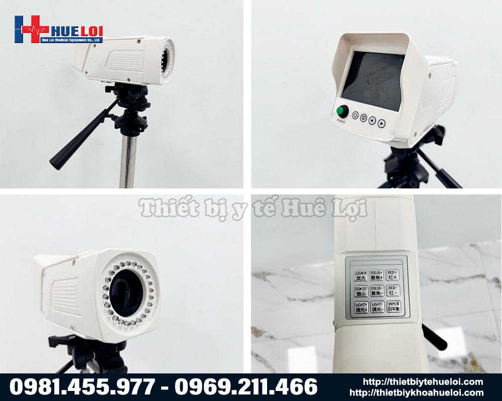Máy soi cổ tử cung Full HD SW-304 Sanwe Medical